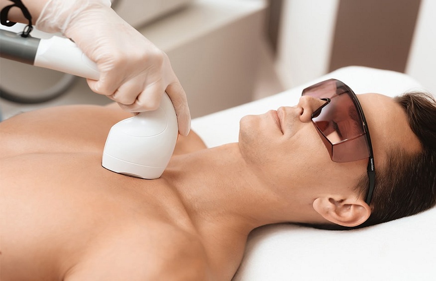 Full Body Laser Hair Removal: 10 Common Questions Answered